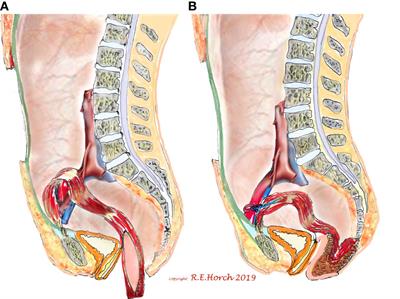 Editorial: Interdisciplinary surgical strategies for complex tumor defects in modern oncology